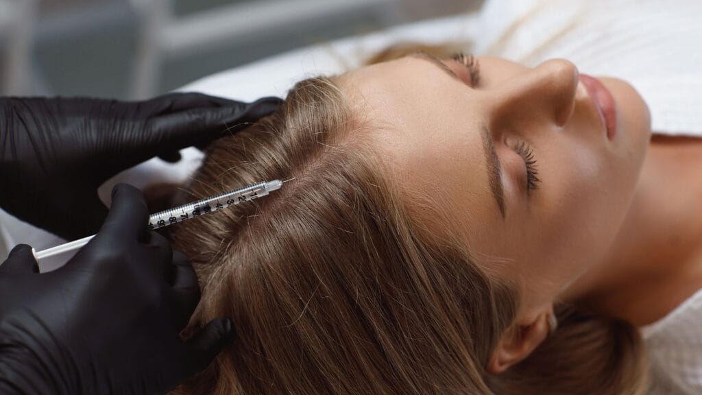 Мезотерапия для волос Кишинев