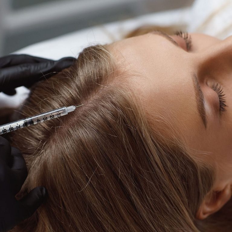 Мезотерапия для волос Кишинев