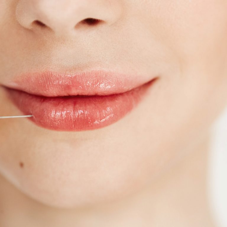 коррекция губ Кишинев