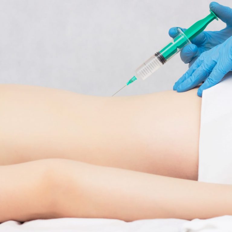 Озонотерапия Кишинев